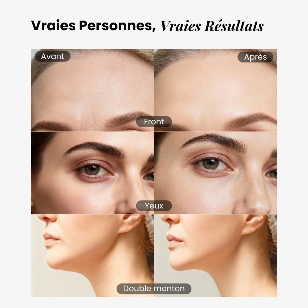Brosse lymphatique faciale Soolym ™ - Soolym
