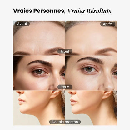 Brosse lymphatique faciale Soolym ™ - Soolym